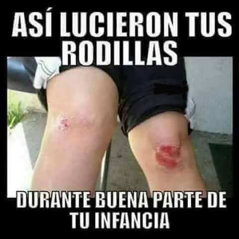 Dos rodillas con raspones y heridas recientes.